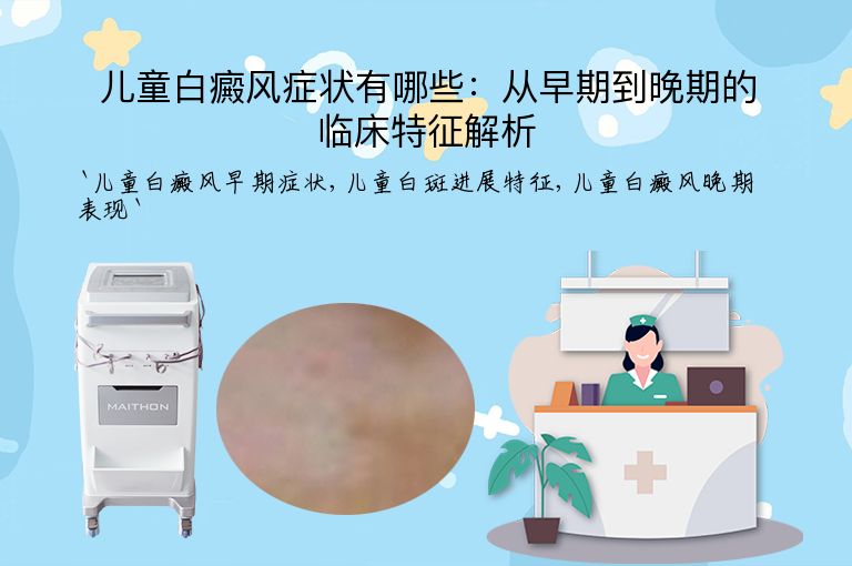 儿童白癜风症状有哪些：从早期到晚期的临床特征解析