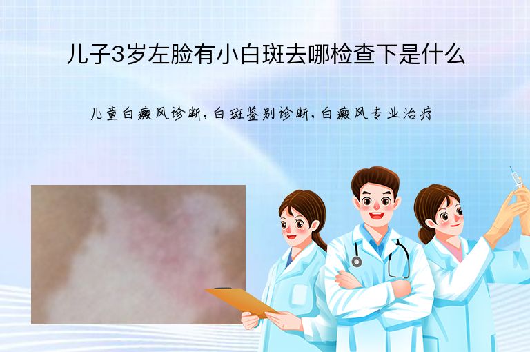 儿子3岁左脸有小白斑去哪检查下是什么”