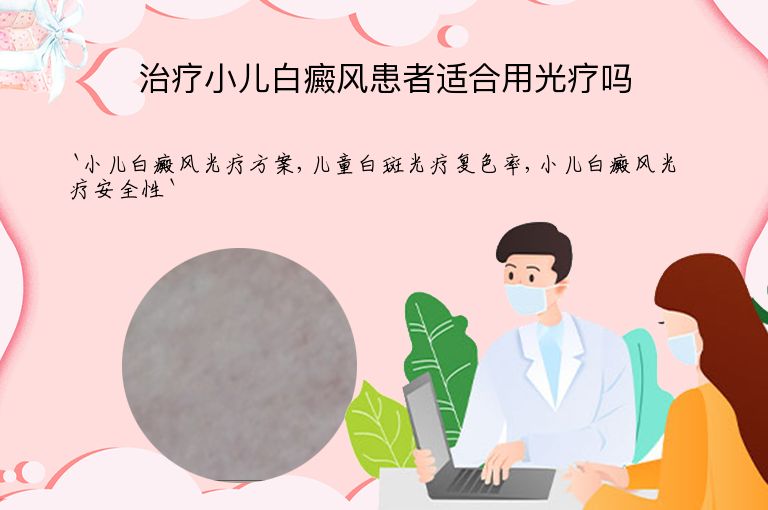 治疗小儿白癜风患者适合用光疗吗