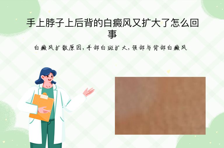 手上脖子上后背的白癜风又扩大了怎么回事”