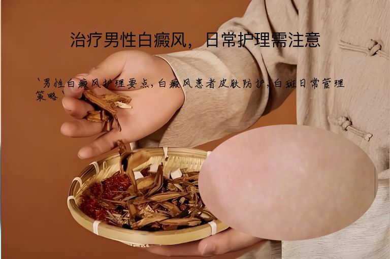 治疗男性白癜风，日常护理需注意