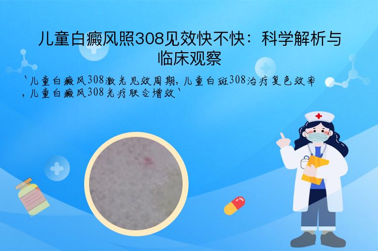 儿童白癜风照308见效快不快:科学解析与临床观察
