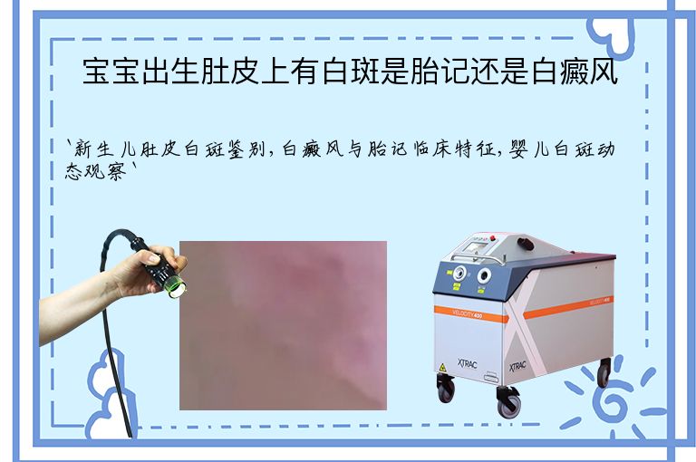 https://www.bdfsjzyy.com/d/file/p/73afe21d4a0083ed79f440be1f0c7409.jpeg