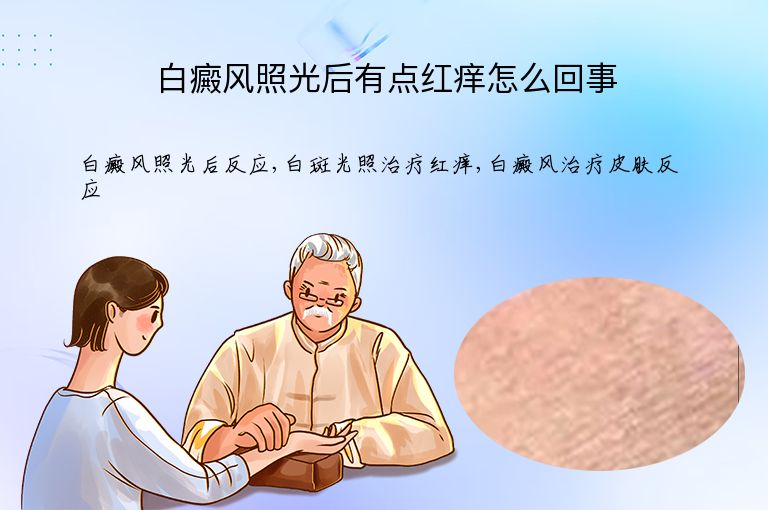白癜风照光后有点红痒怎么回事”