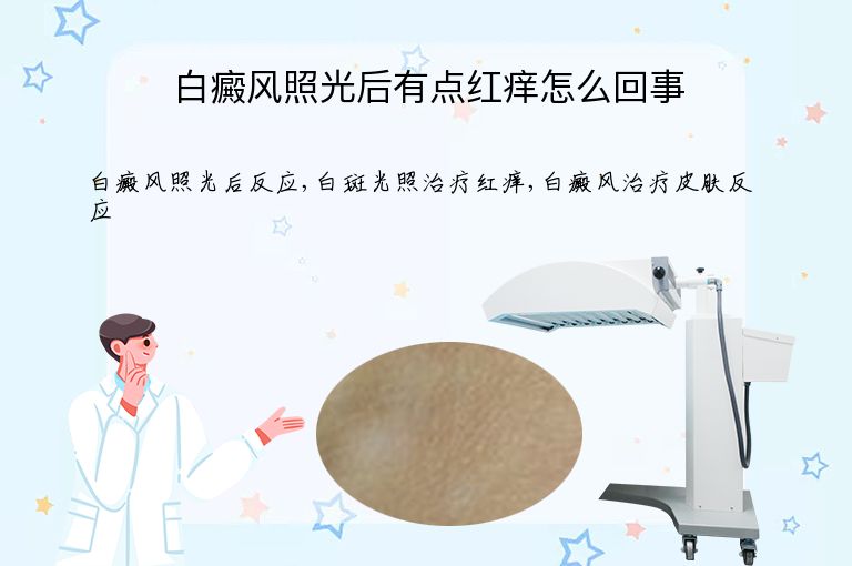 白癜风照光后有点红痒怎么回事”