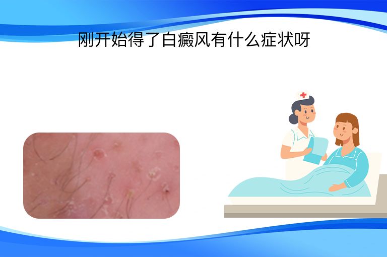 刚开始得了白癜风有什么症状呀