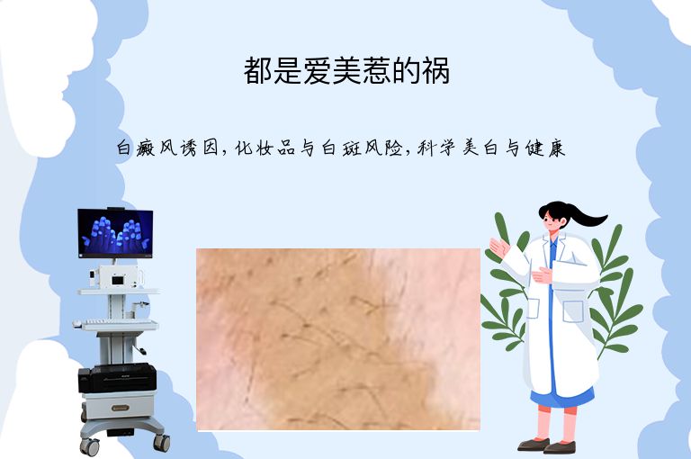 都是爱美惹的祸”