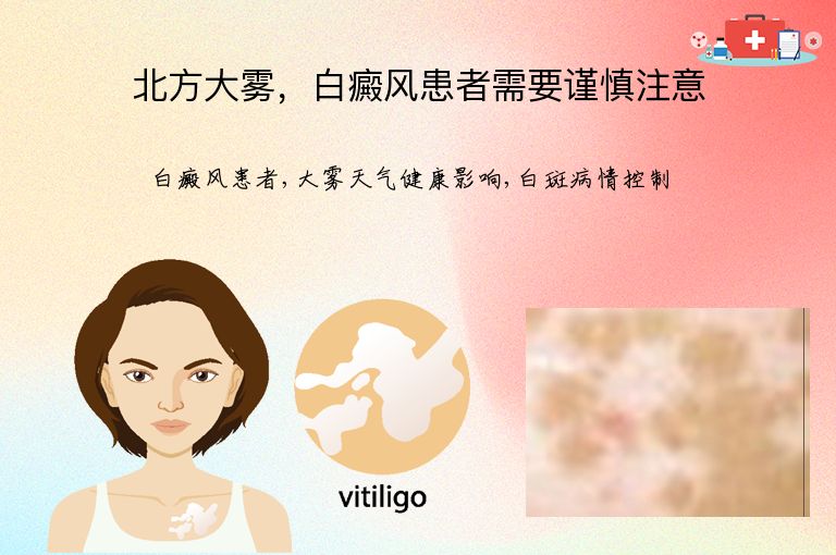https://www.bdfsjzyy.com/d/file/p/5b2f6ea09cb8c626a283b4a5490266c9.jpeg