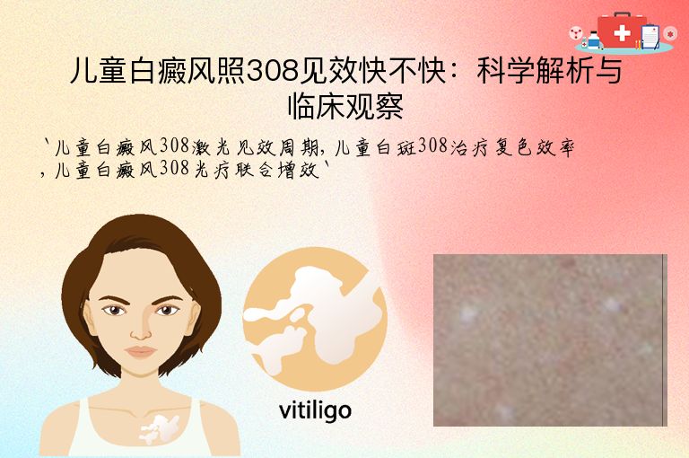 儿童白癜风照308见效快不快：科学解析与临床观察