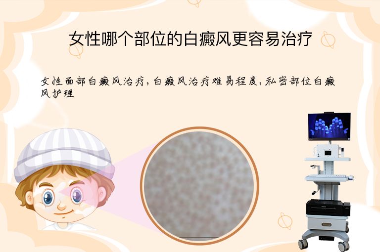 女性哪个部位的白癜风更容易治疗”