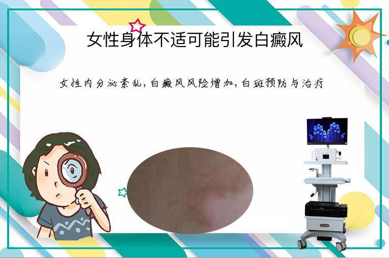女性身体不适可能引发白癜风”