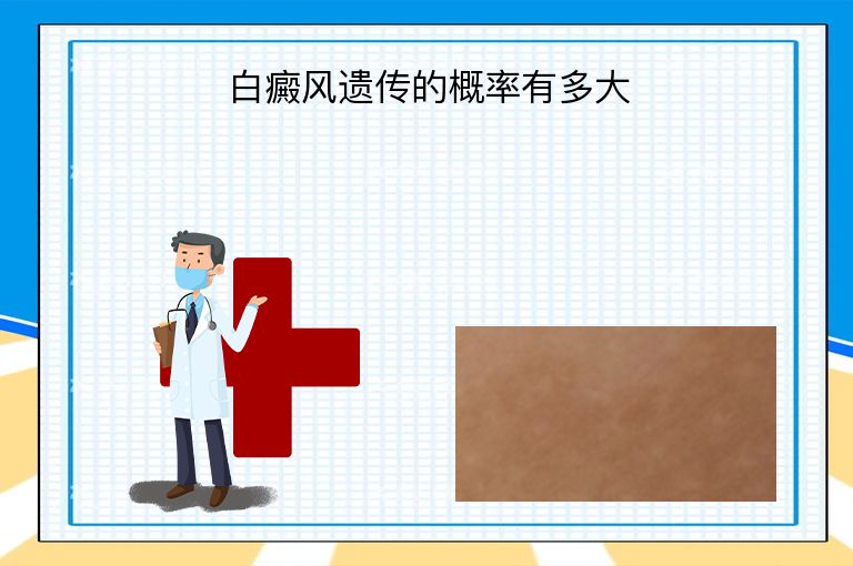 白癜风遗传的概率有多大”