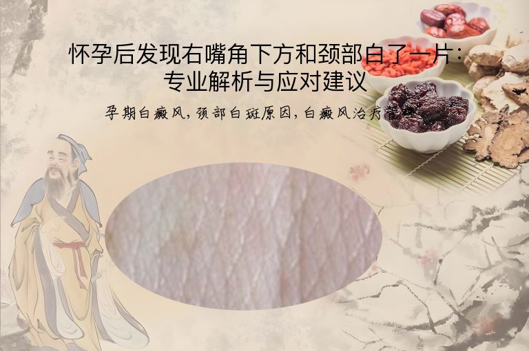 怀孕后发现右嘴角下方和颈部白了一片:专业解析与应对建议”