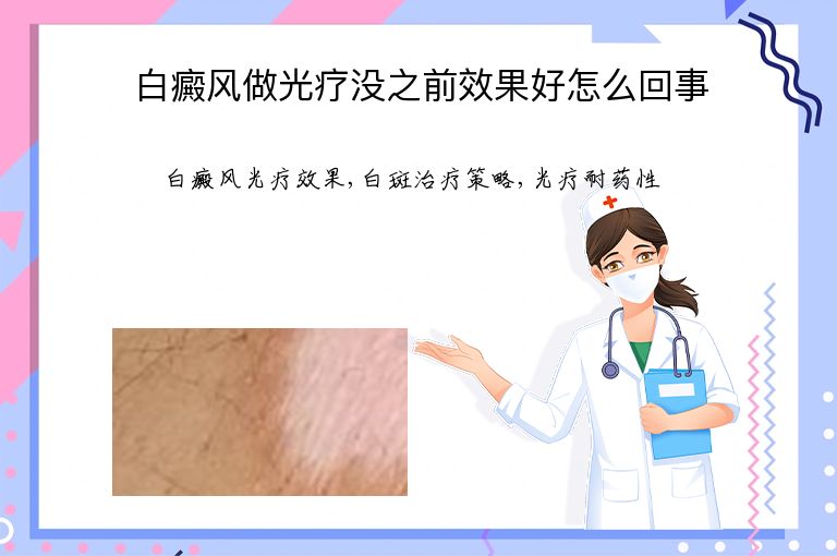 白癜风做光疗没之前效果好怎么回事”