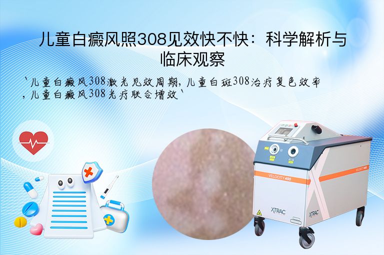 儿童白癜风照308见效快不快：科学解析与临床观察