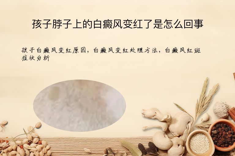 孩子脖子上的白癜风变红了是怎么回事”