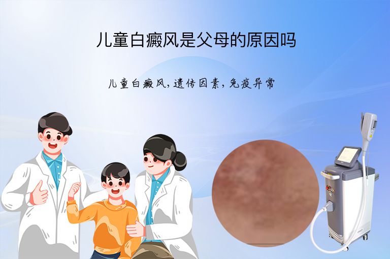 儿童白癜风是父母的原因吗”