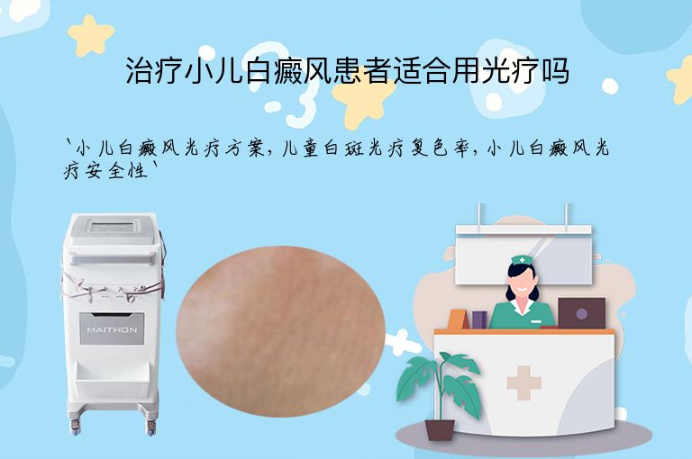 治疗小儿白癜风患者适合用光疗吗