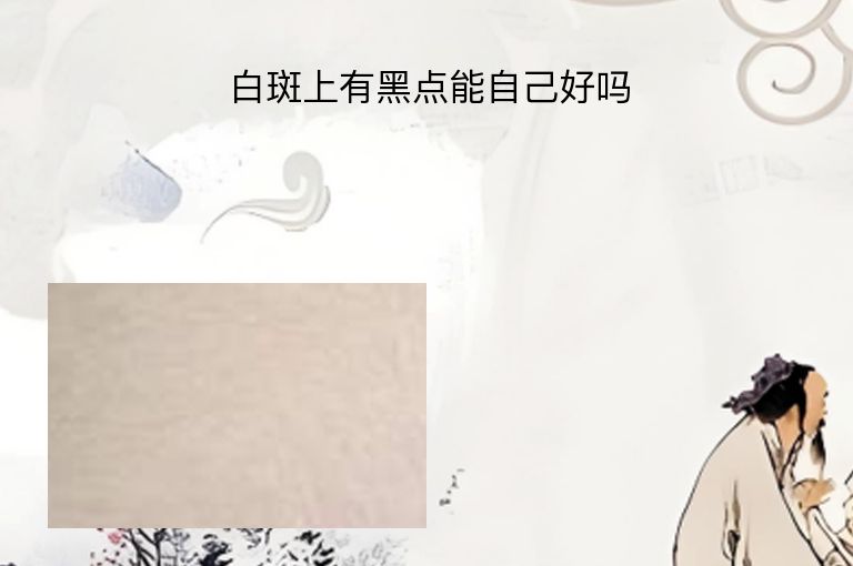 https://www.bdfsjzyy.com/d/file/p/ebe21f9c7475f4f09c303628179eaa89.jpeg