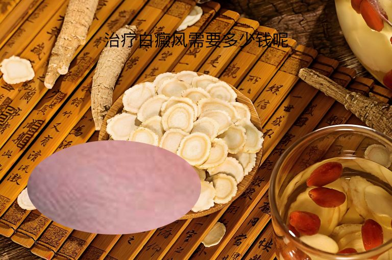治疗白癜风需要多少钱呢”