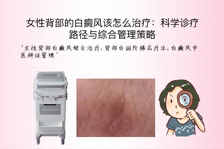女性背部的白癜风该怎么治疗：科学诊疗路径与综合管理策略