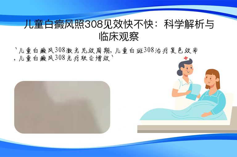 儿童白癜风照308见效快不快：科学解析与临床观察