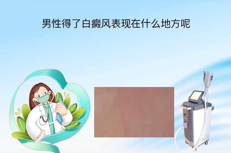 https://www.bdfsjzyy.com/d/file/p/fc6c9aec29ccdf225c2dc2573630340a.jpeg