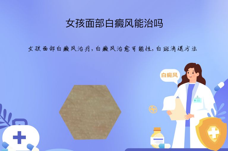 女孩面部白癜风能治吗”