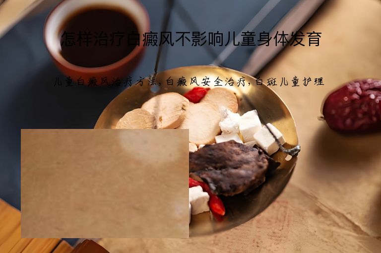 怎样治疗白癜风不影响儿童身体发育”