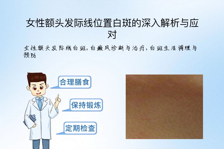 女性额头发际线位置白斑的深入解析与应对”