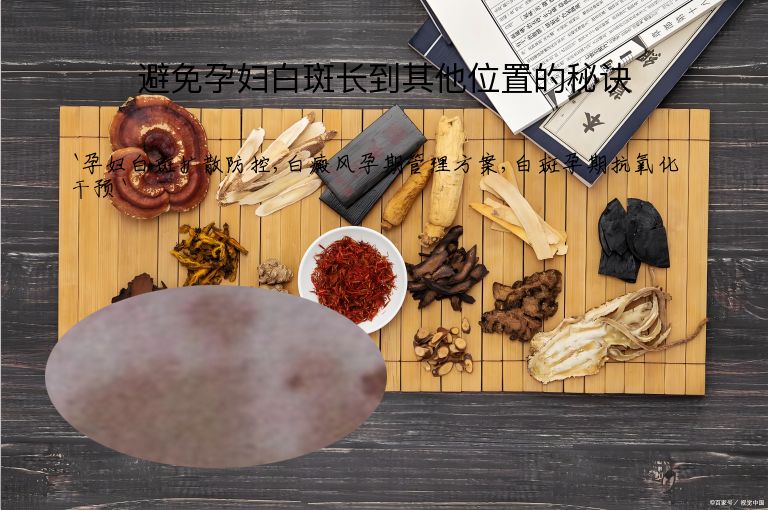 避免孕妇白斑长到其他位置的秘诀