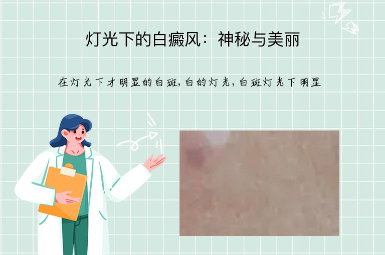灯光下的白癜风:神秘与美丽”