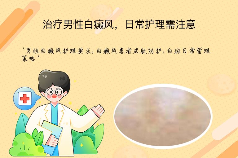 治疗男性白癜风,日常护理需注意