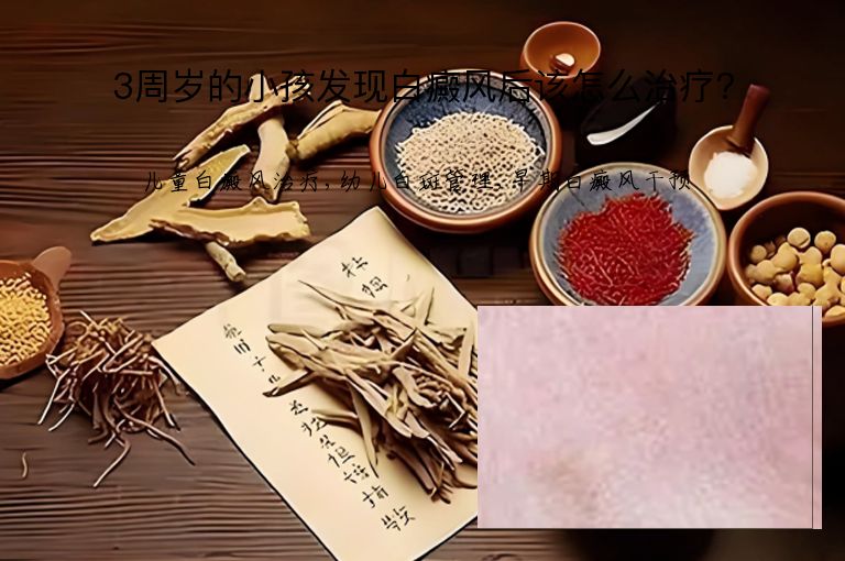 3周岁的小孩发现白癜风后该怎么治疗?”