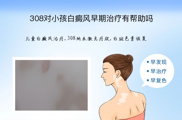 308对小孩白癜风早期治疗有帮助吗”