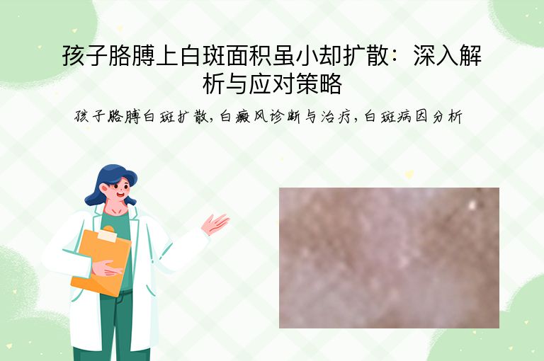 https://www.bdfsjzyy.com/d/file/p/1e7b255c9e7be352743e66c966c35a2d.jpeg