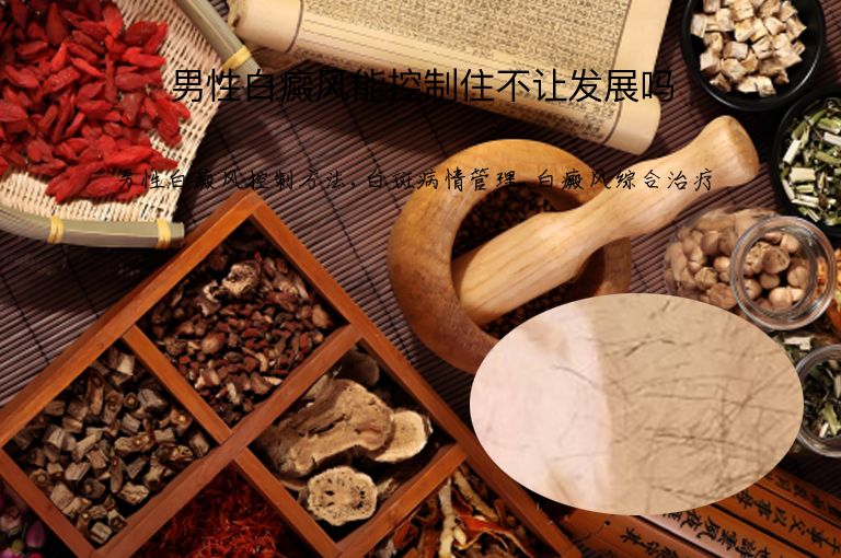 男性白癜风能控制住不让发展吗”