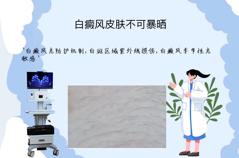 白癜风皮肤不可暴晒