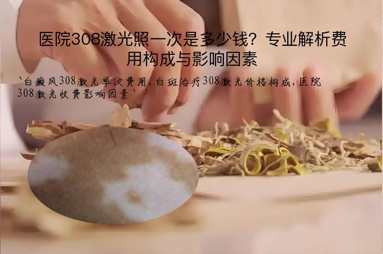 医院308激光照一次是多少钱？专业解析费用构成与影响因素”