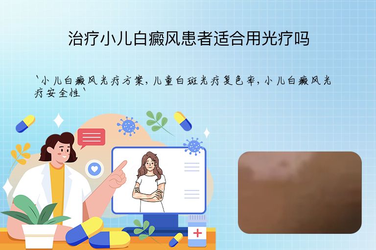 治疗小儿白癜风患者适合用光疗吗