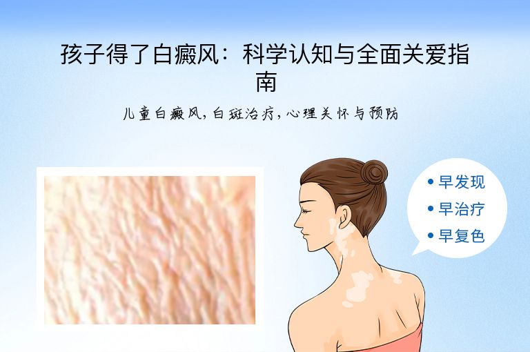 孩子得了白癜风：科学认知与全面关爱指南”
