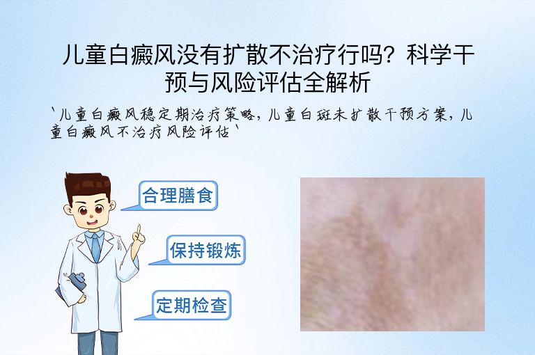 儿童白癜风没有扩散不治疗行吗？科学干预与风险评估全解析