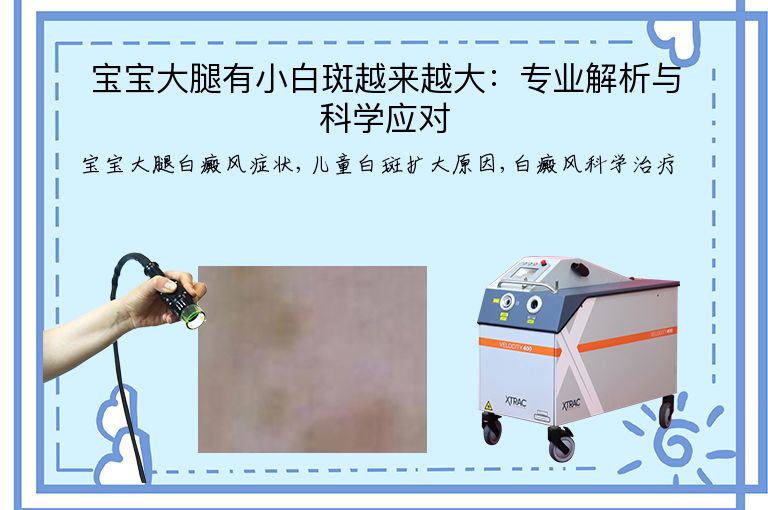https://www.bdfsjzyy.com/d/file/p/8990f030f89a15867146b630e262d313.jpeg
