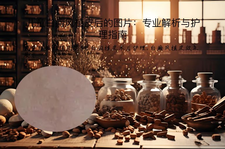 儿童白癜风植皮后的图片：专业解析与护理指南”