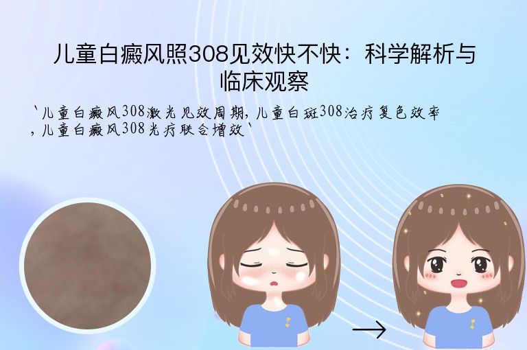儿童白癜风照308见效快不快:科学解析与临床观察