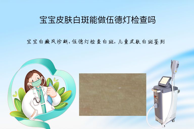 宝宝皮肤白斑能做伍德灯检查吗”
