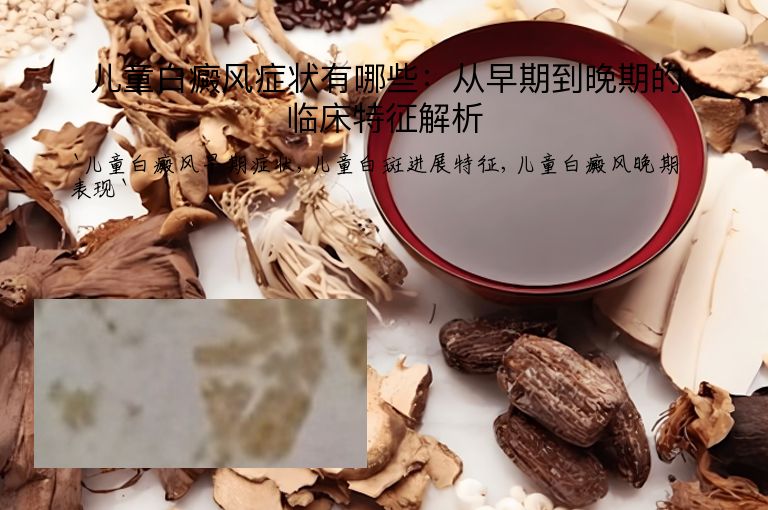 儿童白癜风症状有哪些：从早期到晚期的临床特征解析
