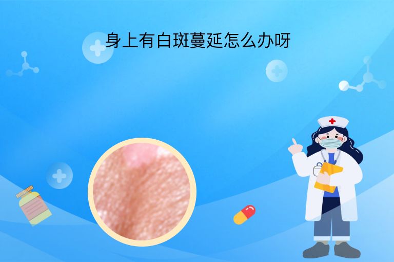身上有白斑蔓延怎么办呀”