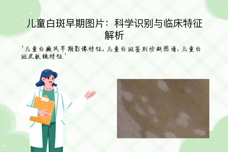 儿童白斑早期图片:科学识别与临床特征解析