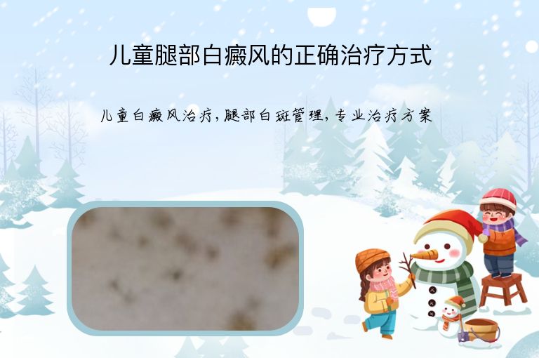 儿童腿部白癜风的正确治疗方式”